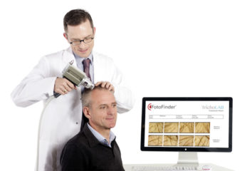 Trichoskopia (komputerowe badanie włosów)
